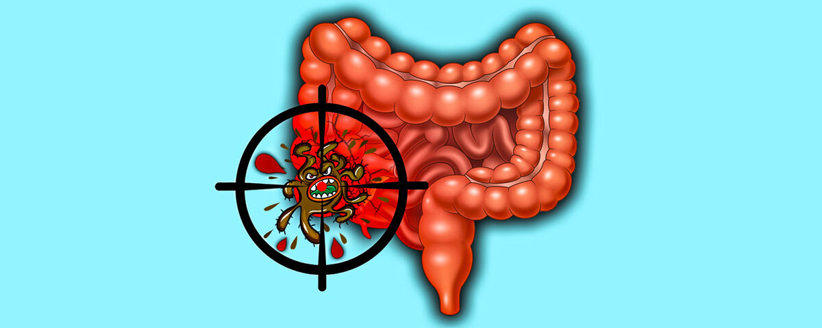 Опасный кандидоз кишечника: симптомы, причины и лечение