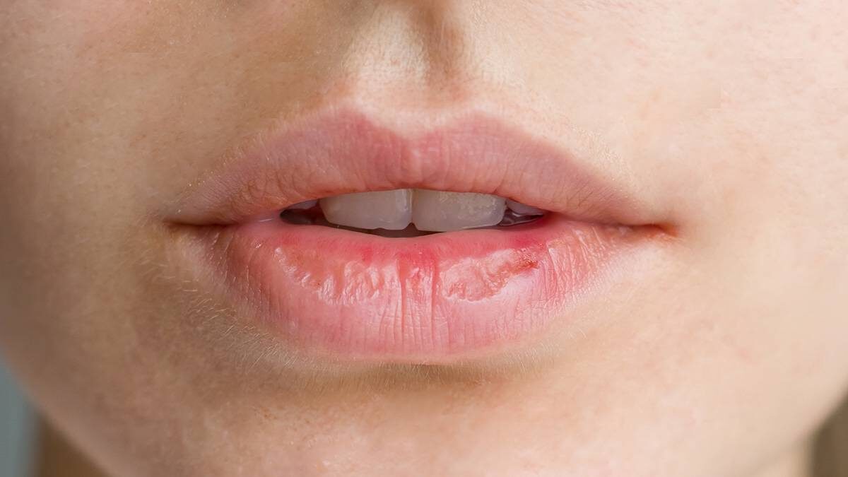    Фото: shutterstock