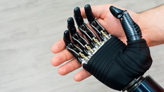    В России запустят высокотехнологичное производство комплектующих для экзопротезов Екатерина Щербакова