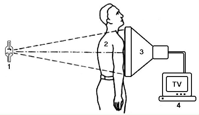 Принцип получения рентгеновского изображения