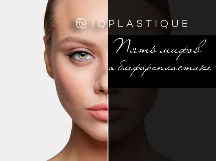 Топ−5 мифов о блефаропластике - разоблачение на реальных примерах