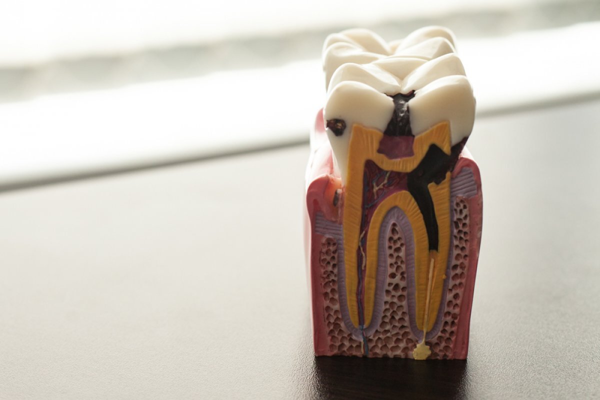    Врач-стоматолог назвала томичам напитки, которые вредят зубам