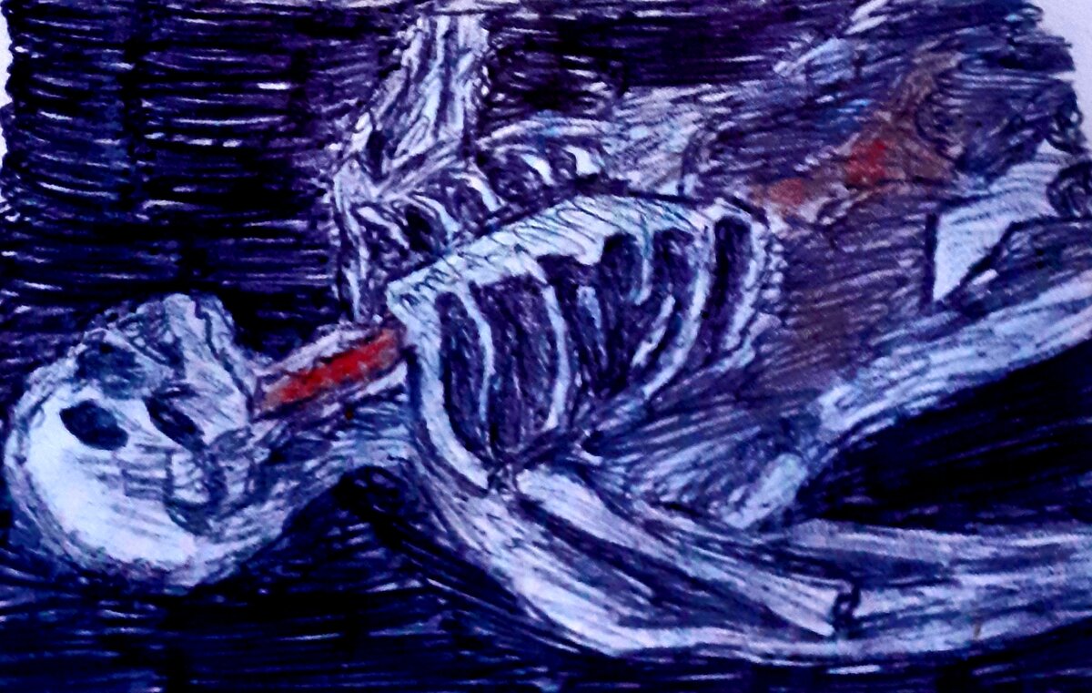 При падении с высоты 8 м ломается позвоночник по всей длине. Осколки костей вызывают обширное внутреннее кровотечение и выводят из строя внутренние органы. Тазовые кости тоже ломаются, разрывая кишечник и мочевой пузырь. У этого мужчины не было шансов выжить. Смерть наступила в течение 3-х минут.