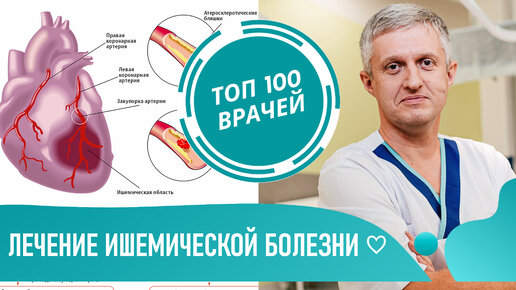 100 докторов