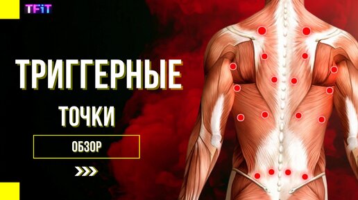 Триггерные точки (обзор)