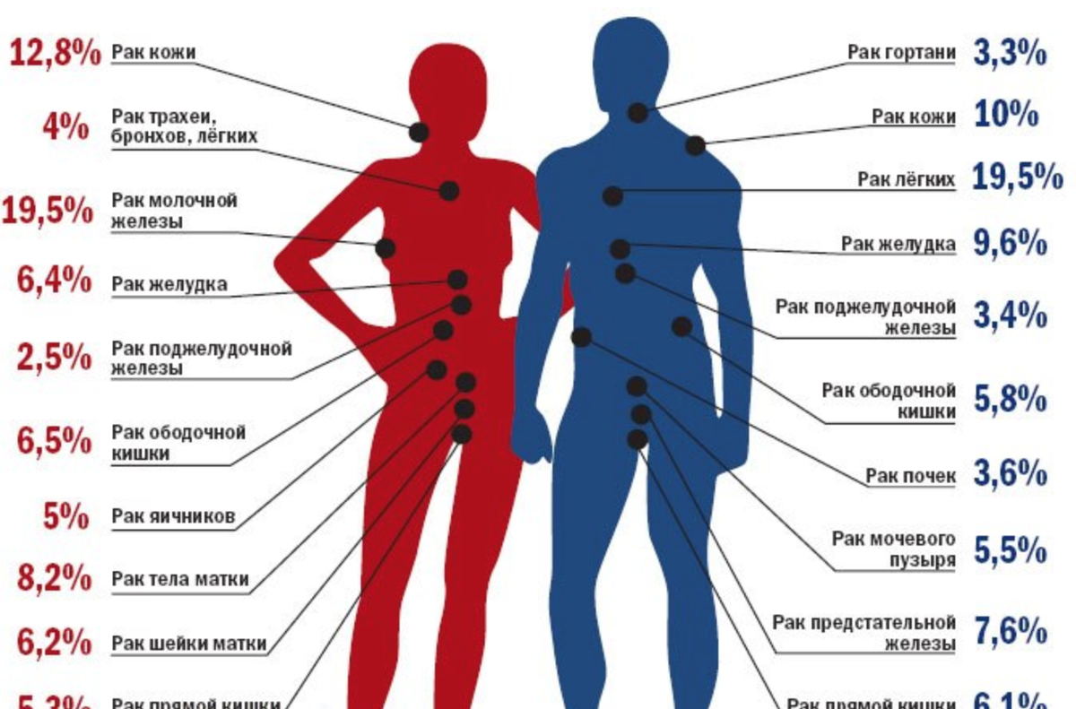 Онкологические заболевания. Онкологические заболевания список. Статистика онкологических заболеваний. Разновидности раковых заболеваний.