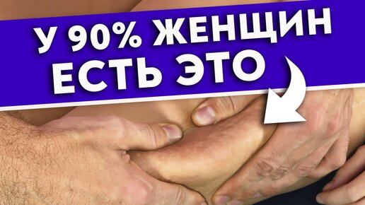 Tải video: Как убрать обвисшую кожу передней поверхности бедра?