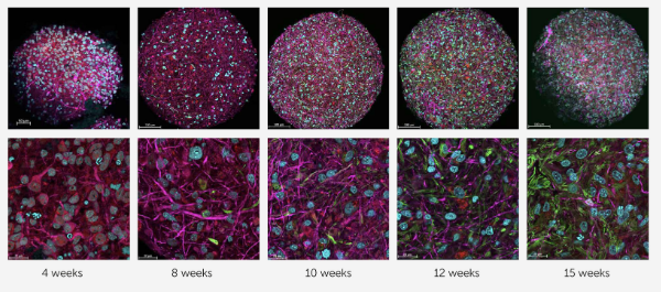 Дифференцировка органоидов мозга с течением времени (от 4 до 15 недель) Источник изображения: frontiersin.org/journals/science/articles/10.3389/fsci.2023.1017235