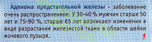 АДЕНОМА ПРЕДСТАТЕЛЬНОЙ ЖЕЛЕЗЫ -ЗАБОЛЕВАНИЕ ОЧЕНЬ РАСПРОСТРАНЕННОЕ. У 30-40% МУЖЧИН СТАРШЕ 50 ЛЕТ И 75-90%, СТАРШЕ 65 ВОЗНИКАЮТ ВОЗНИКАЮТ ИЗМЕНЕНИЯ  В ВИДЕ РАЗРАСТАНИЯ ЖЕЛЕЗИСТОЙ ТКАНИ В ОБЛАСТИ ШЕЙКИ МОЧЕВОГО ПУЗЫРЯ. 