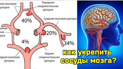 Измученный мозг задыхается от нехватки крови, слабеет разум и память? Причина в компрессии средней мозговой артерии. Как выбрать упражнения?