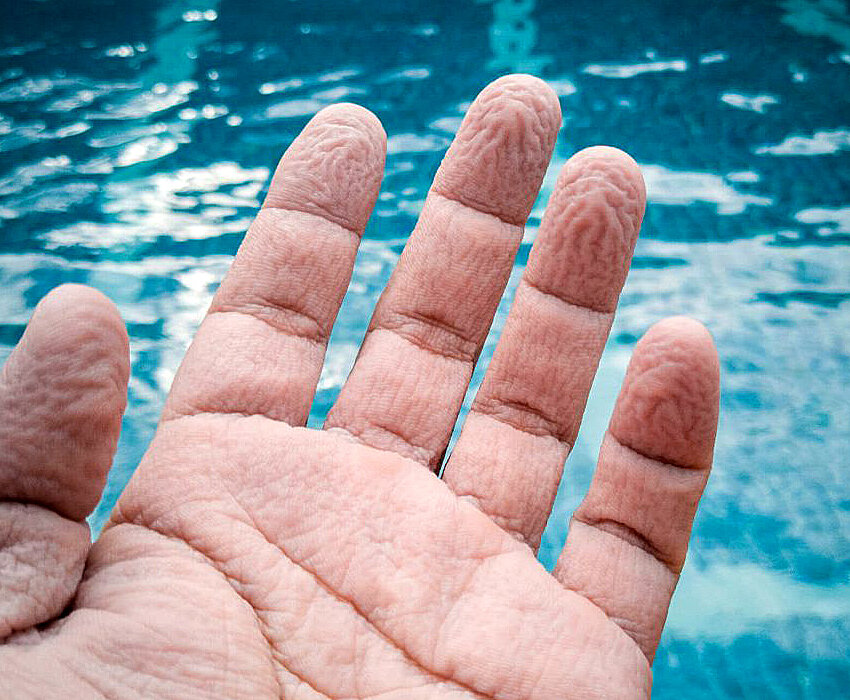 Почему после долгого нахождения в воде кожа на пальцах морщится