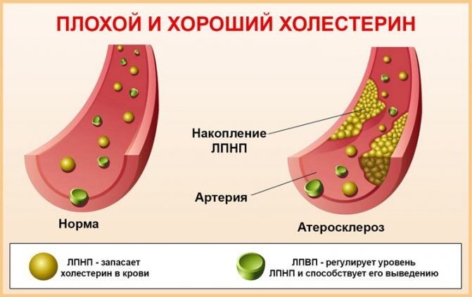 Холестери́н (др.-греч. χολή «жёлчь» + στερεός «твёрдый»), холестеро́л (англ.-2