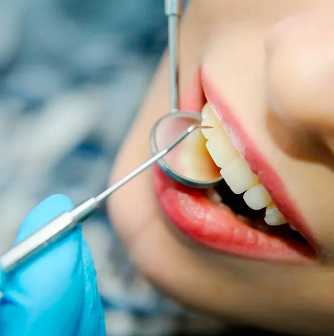 На раннем сроке зубы можно лечить