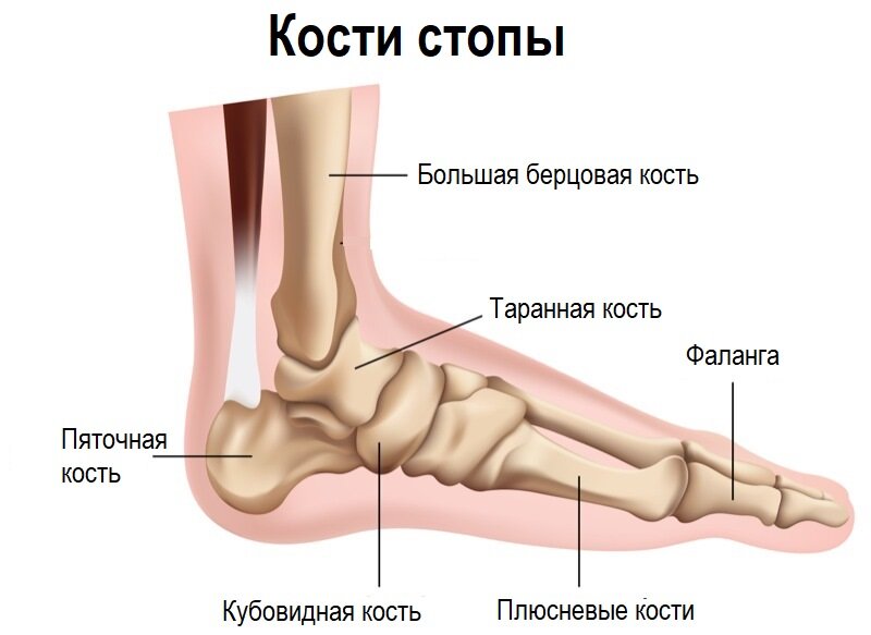 Пяточная шпора у детей