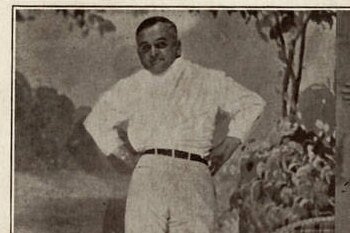     Он выкручивал голову на 180 градусов - и не умирал! История человека-совы