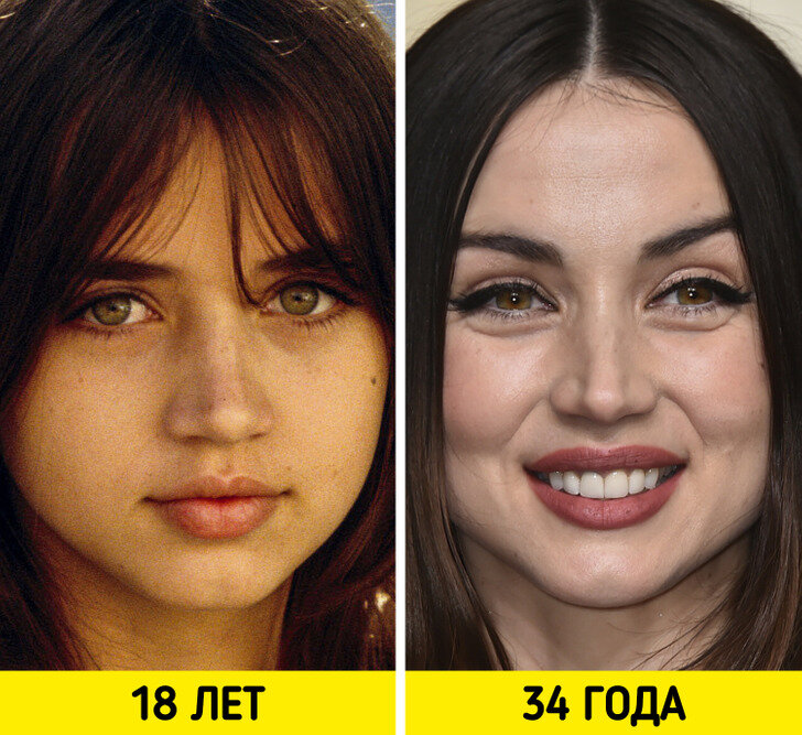 Ана де армас пластика до и после