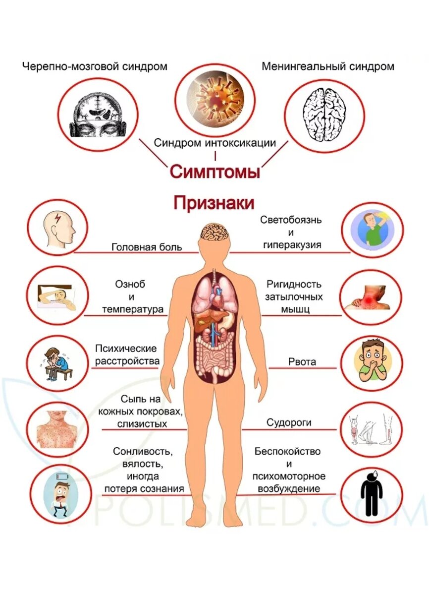 Признаки м. Основные симптомы менингита. Менингит симптомы у взрослых.