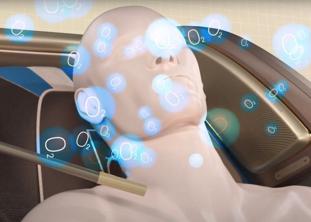 -2