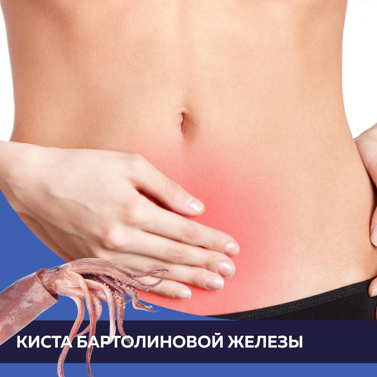 Расположение бартолиновых желез фото Абсцесс бартолиновой железы