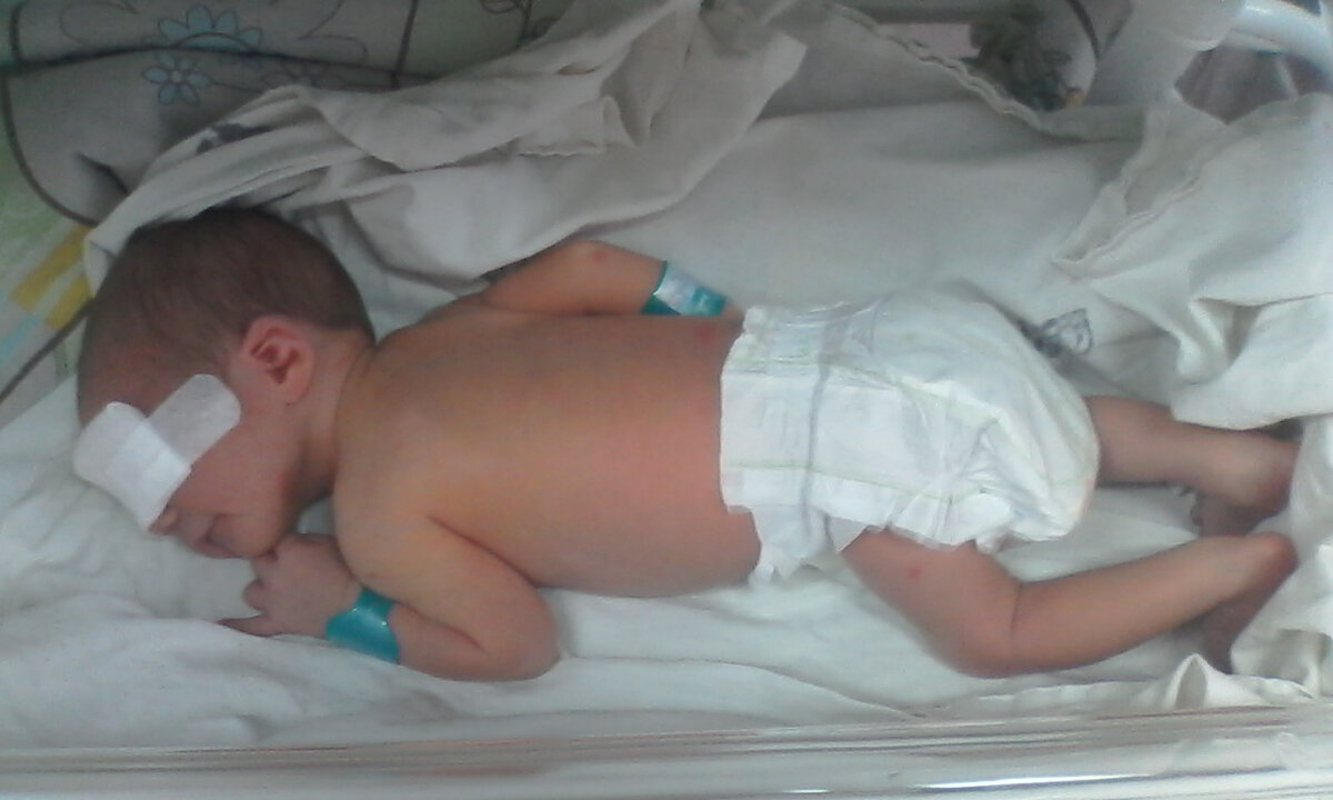 Второй ребенок, сынок. Лежали в роддоме под лампой - загорали