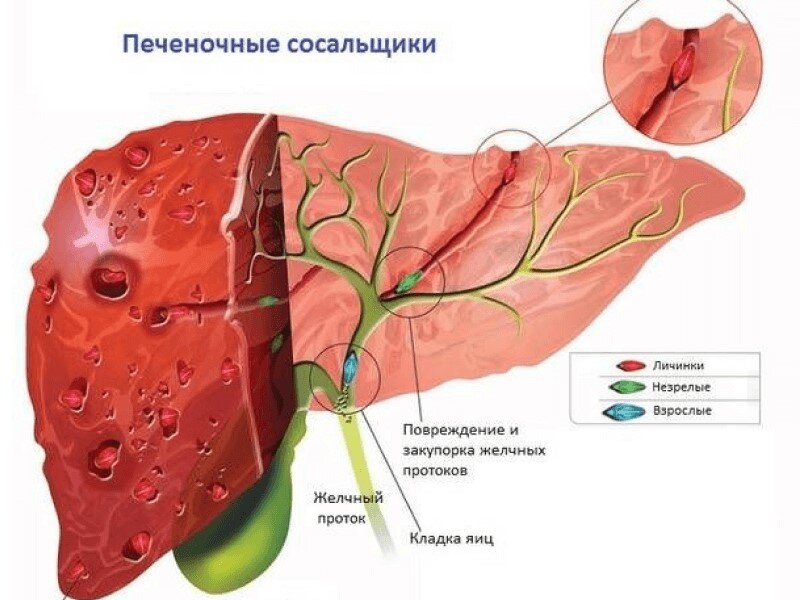 Как узнать или понять, что ребенок заразился глистами?