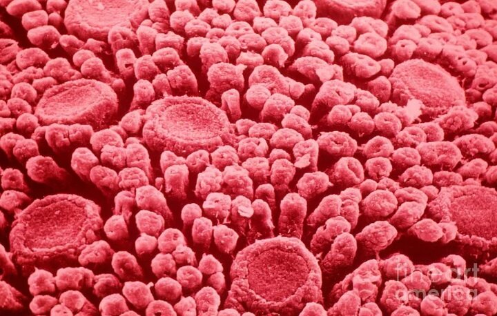 Те самые - вкусовые сосочки :)