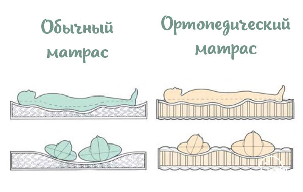 Преимущество ортопедического матраса.