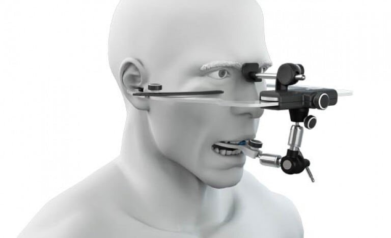 Исходя из полученного положения нижней челюсти мы выполняем функциональные работы, которые сводят к минимуму дискомфортные ощущения при ортодонтическом лечении, сколах на зубах либо коронках и увеличивают срок службы  ортопедических конструкций. Полученное положение, которое мы фиксируем с помощью миоцентрика, регистрируется в полости рта с помощью лицевой дуги. Все аналитические ориентиры передаются в лабораторию.  

С помощью ТЕНС-терапии мы можем исправить дискомфортное, проблемное и вынужденное положение нижней челюсти. Это поможет пациенту избавиться от постоянных головных болей, перенапряжения жевательной мускулатуры, болей и шумов в ВНЧС, связанных с положением нижней челюсти.