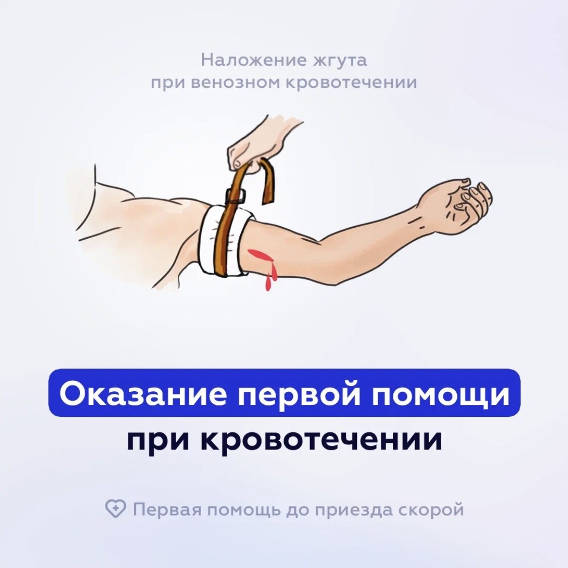 Кровотечение – это истечение крови из кровеносных сосудов в органы, ткани, естественные полости организма или наружу.