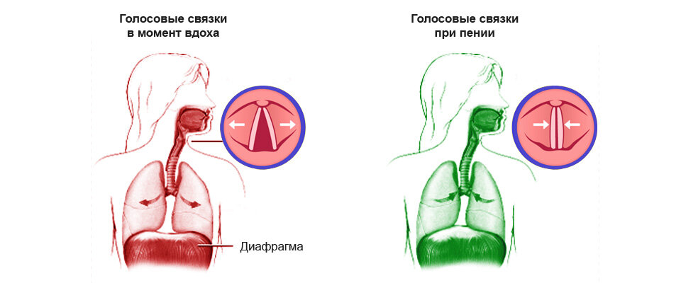 Узелки голосовых связок - доброкачественные образования на голосовых складках