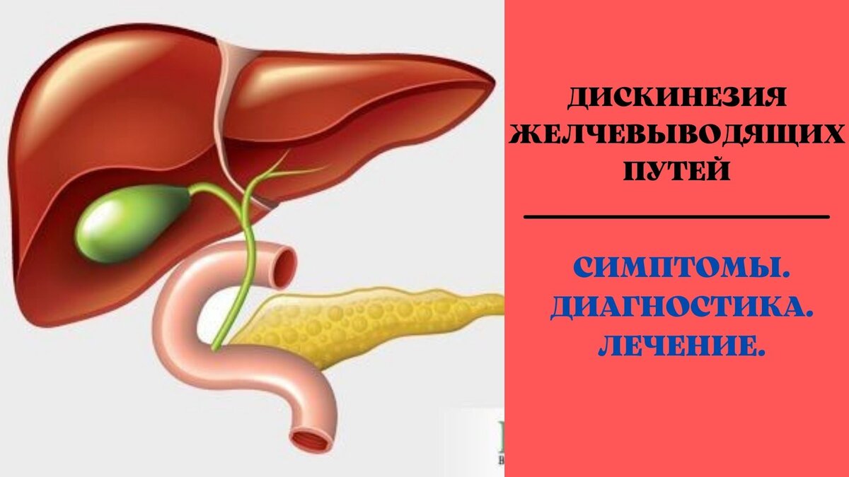 Желчно выводящие пути. Дискинезия поджелудочной железы. Дискинезия ЖВП. Дискинезия желчевыводящих путей картинки. Дискинезия желчных путей.