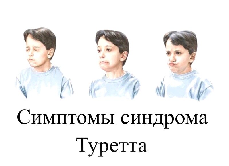 СИНДРОМ ТУРЕТТА | Эпонимы И Мы | Дзен