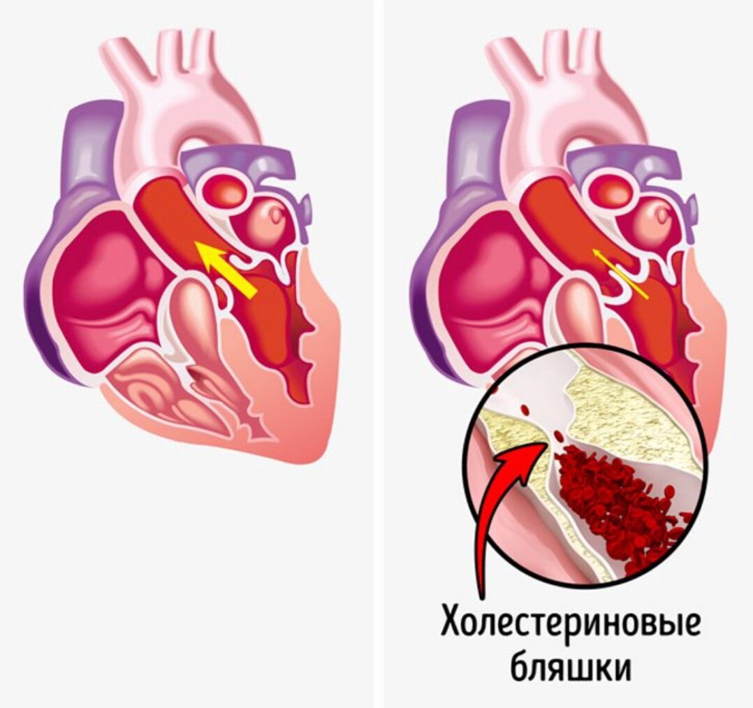 Почему стул вас убивает? Что будет с вашим телом через 10 лет сидячей работы  | Екатерина Юрочкина | Дзен