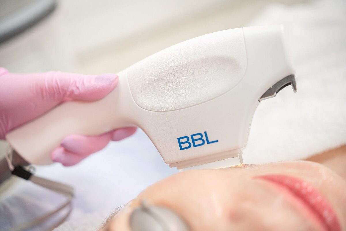 Bbl. Bbl. Фотоомоложение bbl forever young. Фотоомоложение bbl forever young. Сайтон ббл.