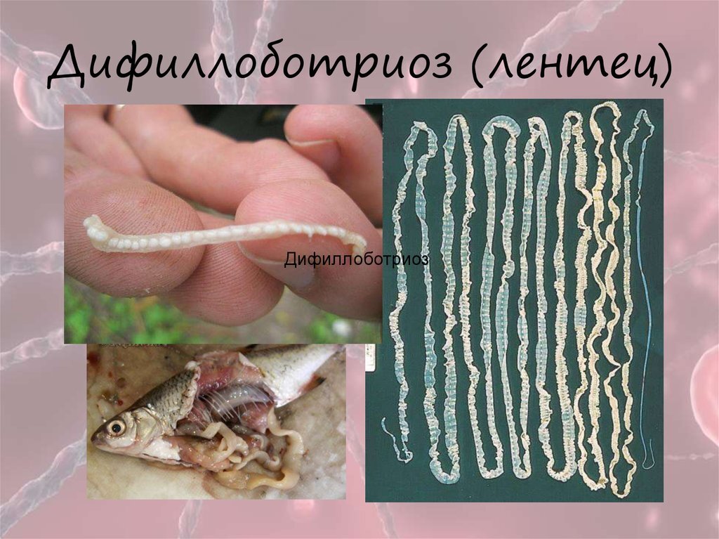 Как выглядит ленточный червь у человека