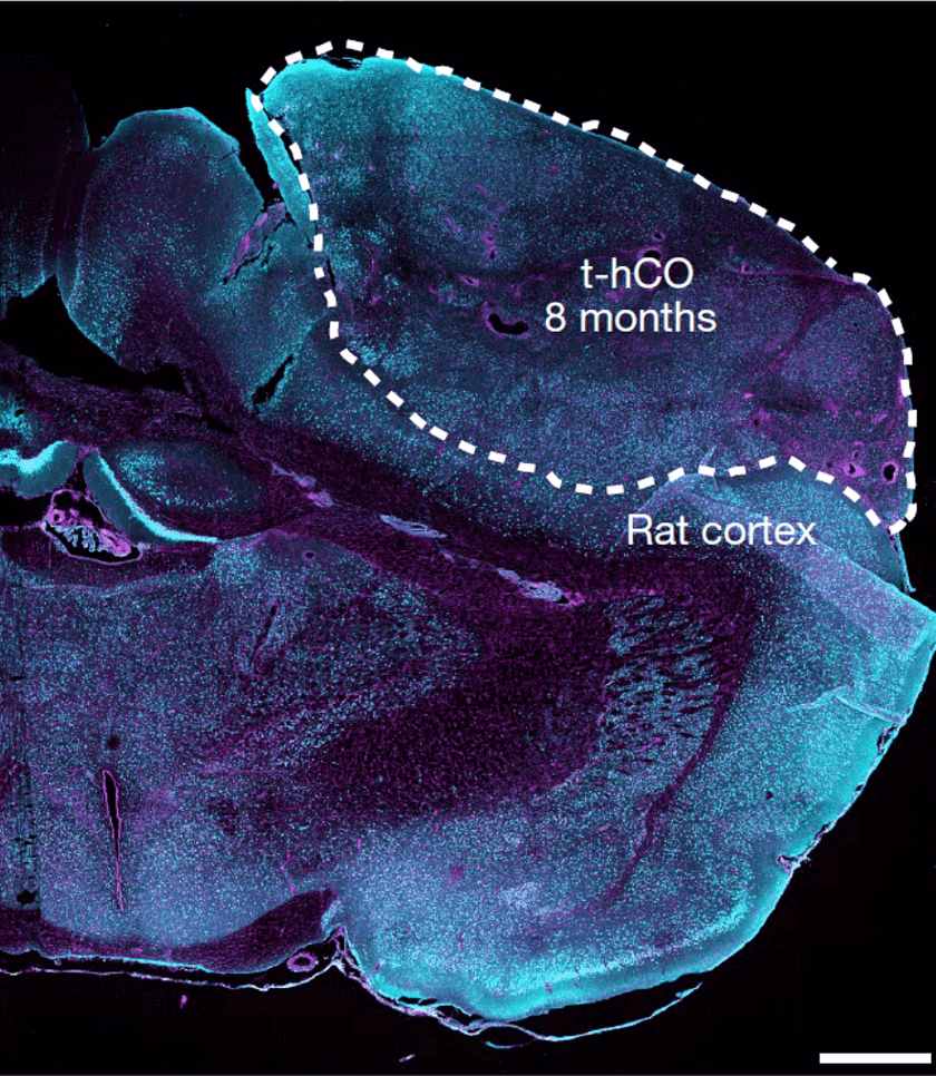    Трансплантат органоида коры головного мозга человека (t-hCO) в головном мозге крысы. Фото: Nature