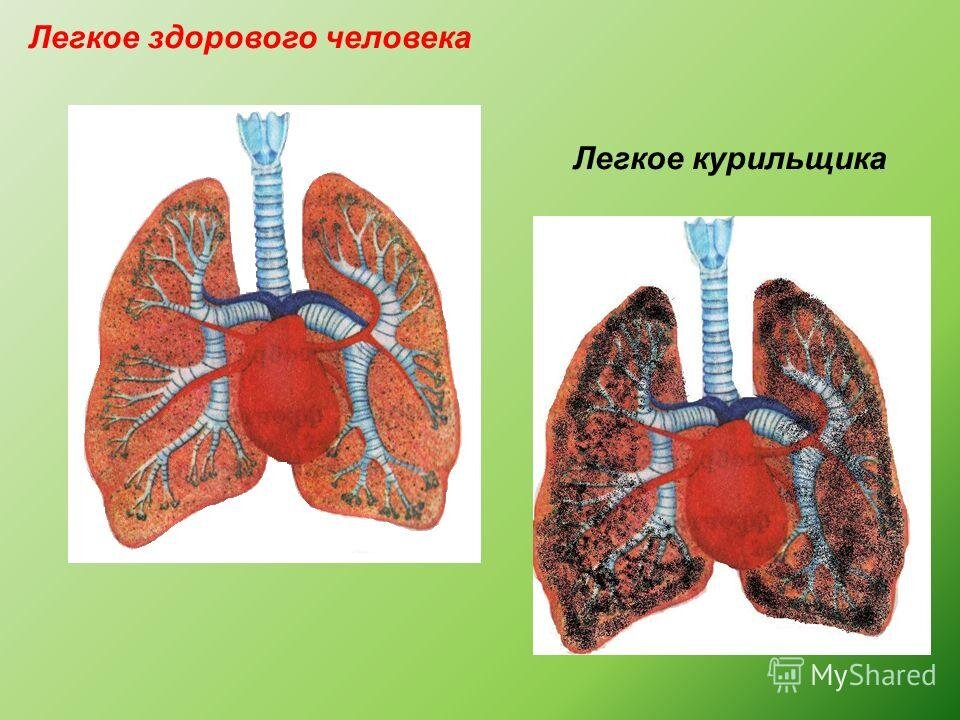 Легкие курильщика рисунок для детей