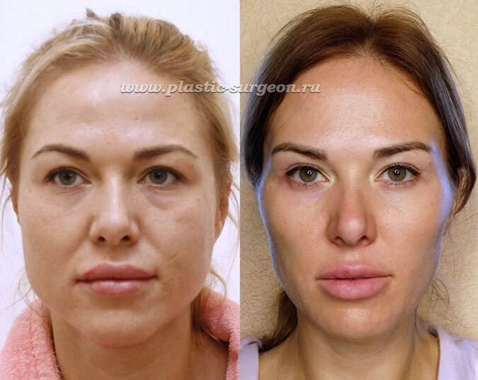 Ирина Мещанская (Шпак) - какой рост и вес, фото, инстаграм, вконтакте?