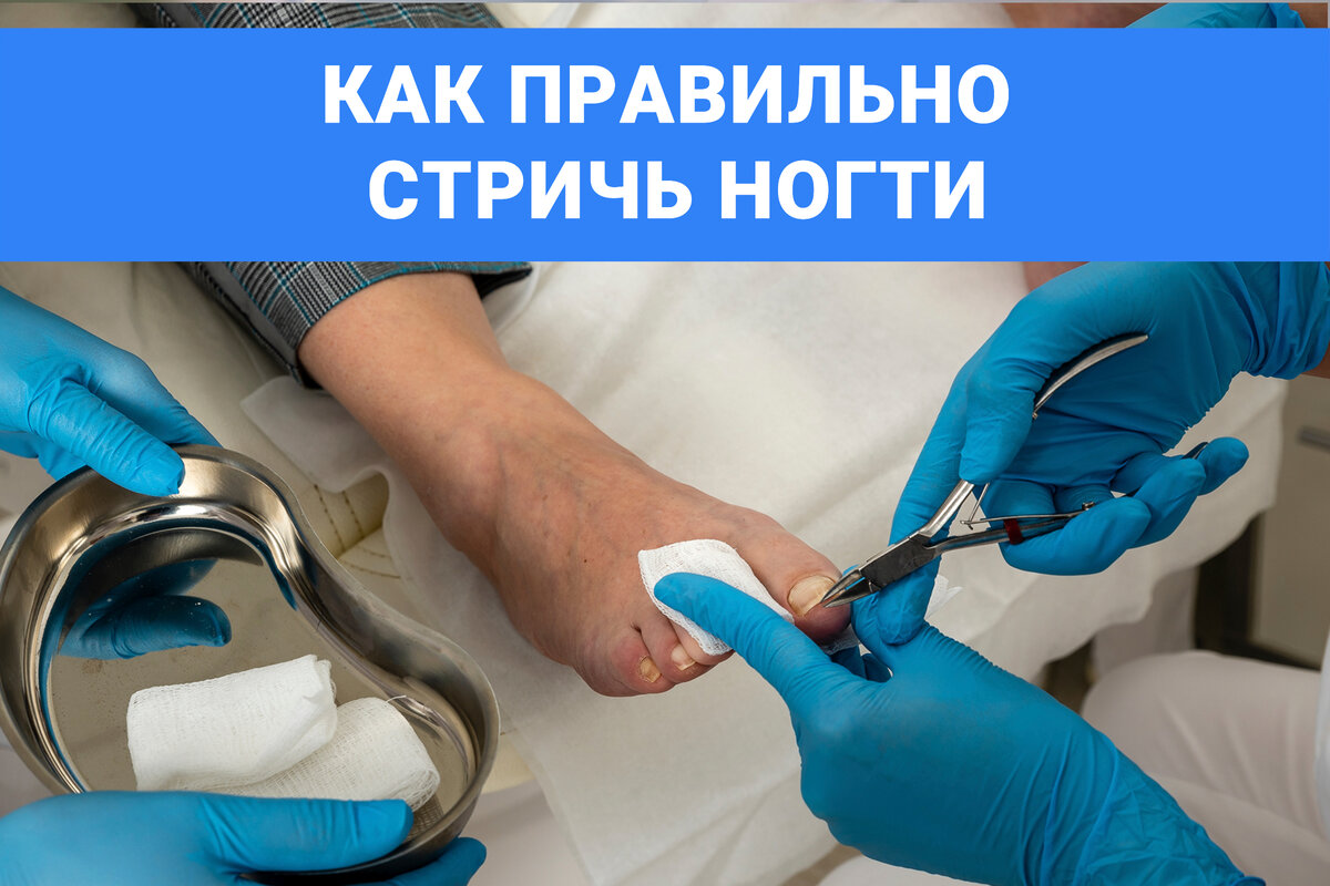 Как снимают ноготь в больнице