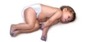 Тетрада Фалло