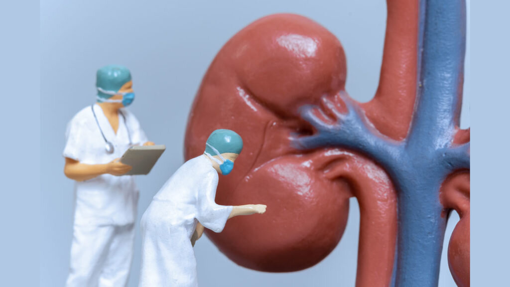   Miniature People Doctor analyzing of patient kidney health ,science and medical concepts Александр Шереметьев