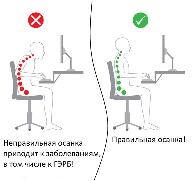 Неправильная осанка может привести к