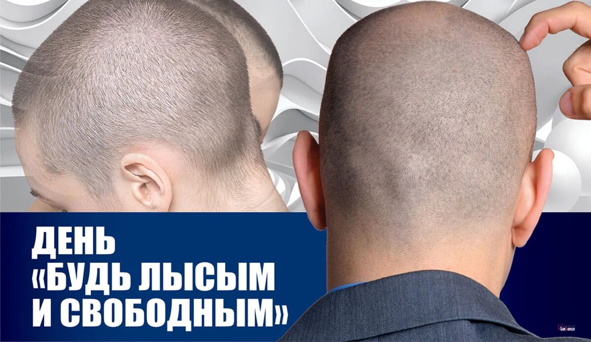 День лысых