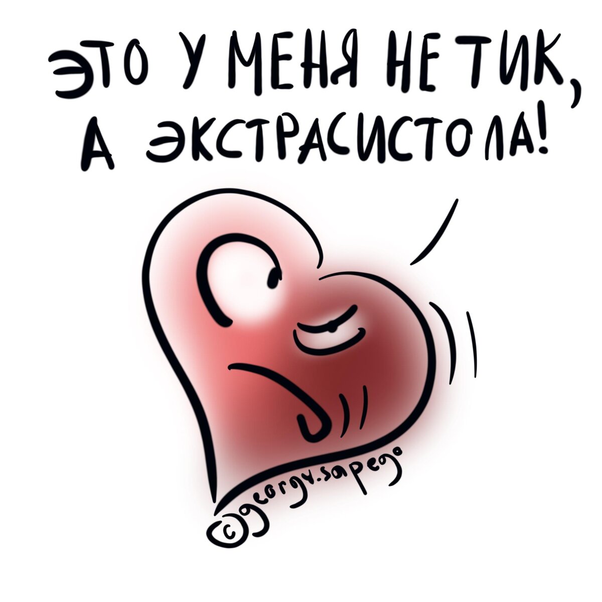 Экстрасистола