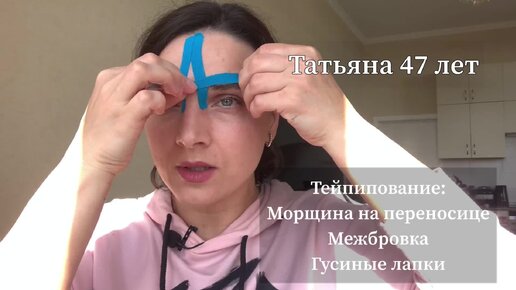 Тейпирование от морщин