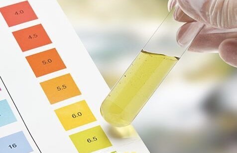 Определение pH по шкале уровня кислотности.