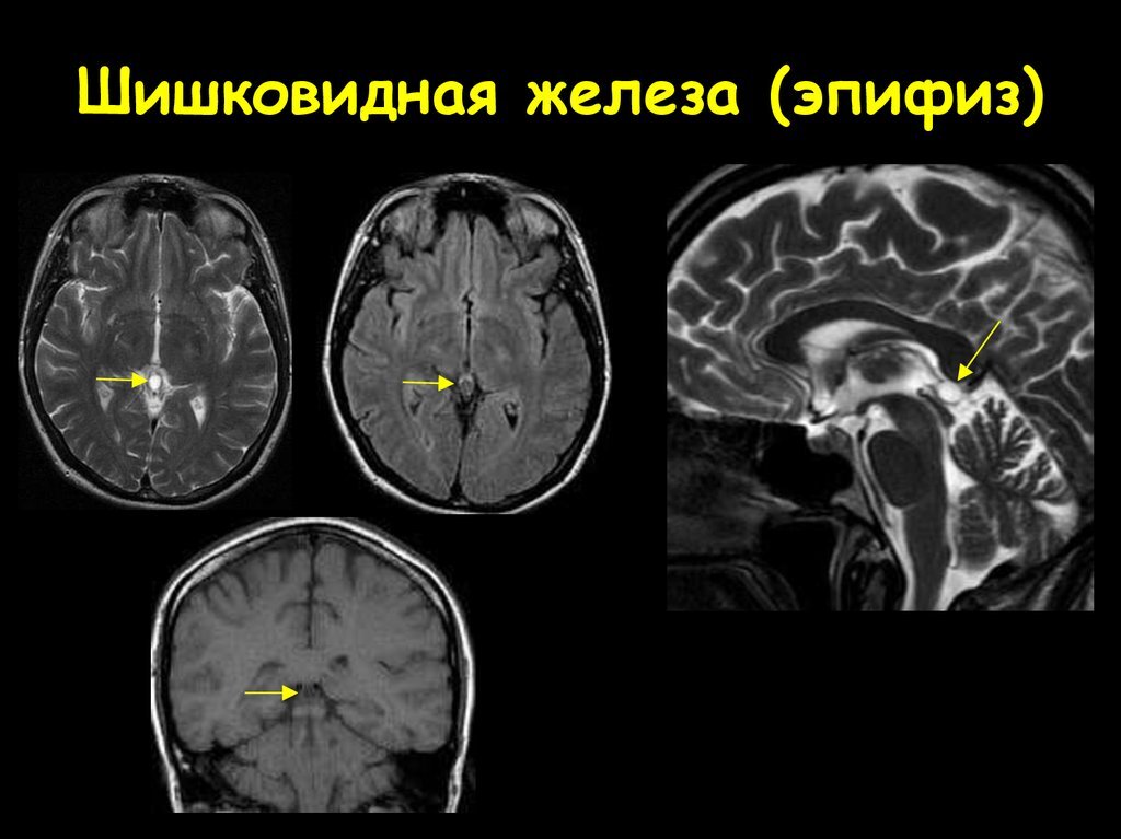 Лечение кисты головного мозга в Германии: инновационный подход