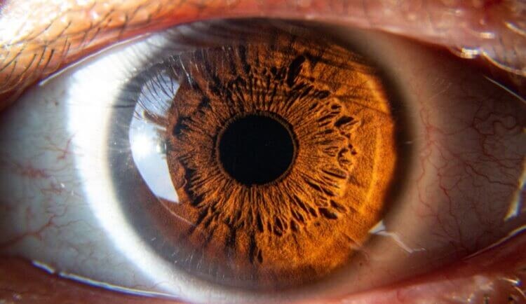 Изначально тиопентал натрия был обезболивающим средством во время операций на глаза