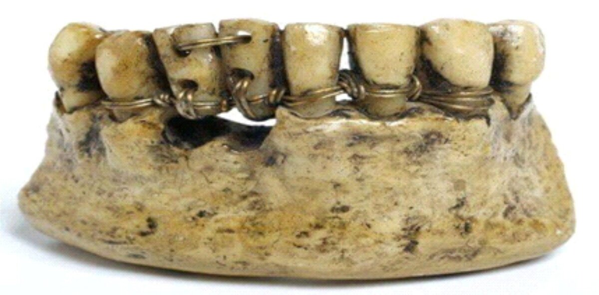 Фото с сайта: https://ailehekimiklinikasi.az/uploads/posts/2018-07/1532933625_001.jpg