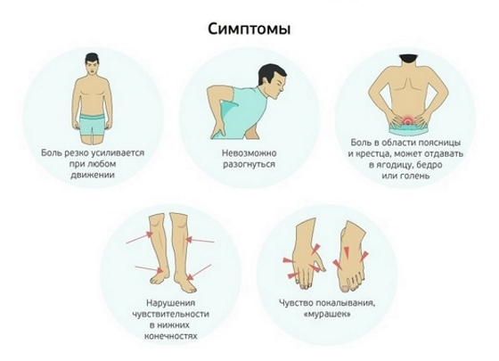 Люмбаго что это такое простыми. Локализация боли в спине. Прострелы и боли в пояснице. Болит поясница симптомы.